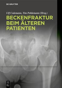 Beckenfraktur beim älteren Patienten