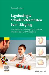 Lagebedingte Schädeldeformitäten beim Säugling
