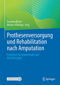 Prothesenversorgung und Rehabilitation nach Amputation und bei angeborener Fehlbildung