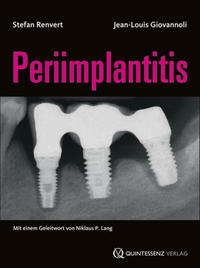 Periimplantitis