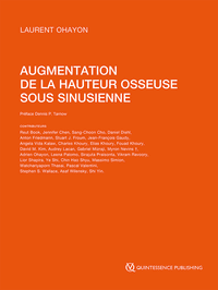 Augmentation de la hauteur osseuse sous sinusienne
